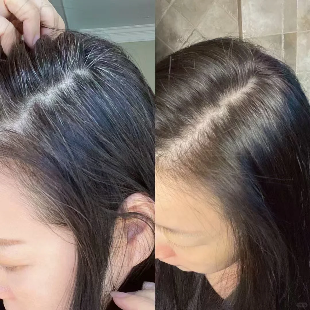 头发白中医怎么调理治疗?新加坡贡方堂TCM陈慧芳一方养回乌黑秀发